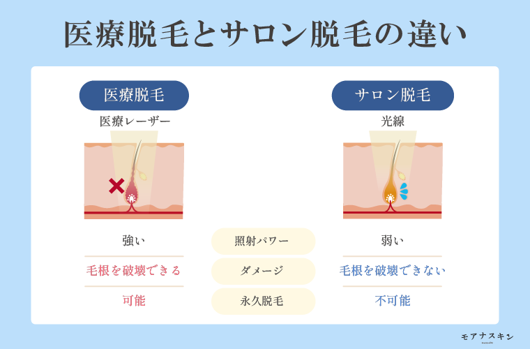 医療脱毛とサロン脱毛の違い