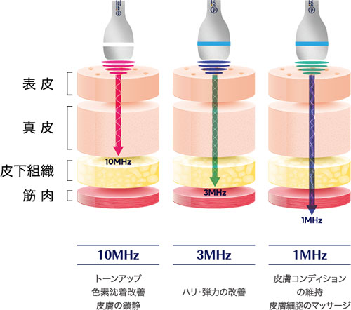 期待される効果